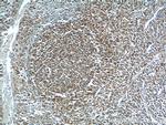 ARHGAP25 Antibody in Immunohistochemistry (Paraffin) (IHC (P))