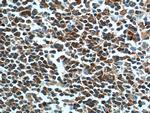 ARHGAP25 Antibody in Immunohistochemistry (Paraffin) (IHC (P))