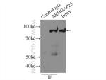 ARHGAP25 Antibody in Immunoprecipitation (IP)