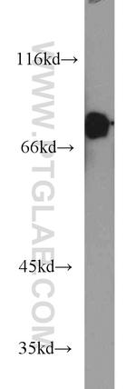 ARHGAP25 Antibody in Western Blot (WB)
