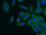RABEP1 Antibody in Immunocytochemistry (ICC/IF)