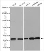 NR1H3 Antibody in Western Blot (WB)