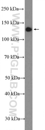 RBP3 Antibody in Western Blot (WB)