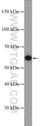 MEF2D Antibody in Western Blot (WB)