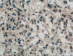 USP15 Polyclonal Antibody
