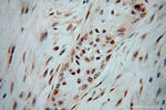 RBM6 Antibody in Immunohistochemistry (Paraffin) (IHC (P))