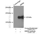 RBM6 Antibody in Immunoprecipitation (IP)