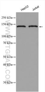 RBM6 Antibody in Western Blot (WB)