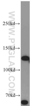 RBM6 Antibody in Western Blot (WB)