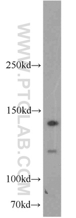 RBM6 Antibody in Western Blot (WB)