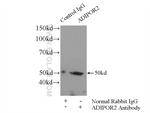 Adiponectin receptor Antibody in Immunoprecipitation (IP)