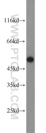 Adiponectin receptor Antibody in Western Blot (WB)
