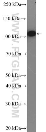 alpha N Catenin Antibody in Western Blot (WB)