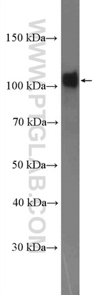 alpha N Catenin Antibody in Western Blot (WB)