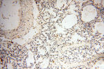 RBM3 Antibody in Immunohistochemistry (Paraffin) (IHC (P))