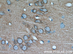 PKC gamma Antibody in Immunohistochemistry (Paraffin) (IHC (P))