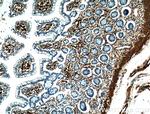 VAP1 Antibody in Immunohistochemistry (Paraffin) (IHC (P))