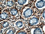 VAP1 Antibody in Immunohistochemistry (Paraffin) (IHC (P))