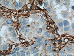 VAP1 Antibody in Immunohistochemistry (Paraffin) (IHC (P))
