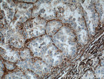 VAP1 Antibody in Immunohistochemistry (Paraffin) (IHC (P))