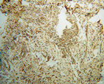FAM175A Antibody in Immunohistochemistry (Paraffin) (IHC (P))