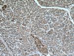 GAA Antibody in Immunohistochemistry (Paraffin) (IHC (P))