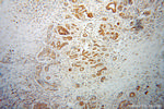 GAA Antibody in Immunohistochemistry (Paraffin) (IHC (P))