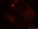 BPI Antibody in Immunocytochemistry (ICC/IF)