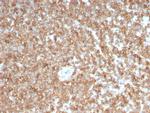GM-CSF (Granulocyte/Macrophage - Colony Stimulating Factor) Monoclonal Antibody (CSF2, 3403)