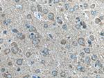 NTM Antibody in Immunohistochemistry (Paraffin) (IHC (P))
