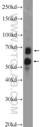 NTM Antibody in Western Blot (WB)