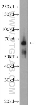 NTM Antibody in Western Blot (WB)