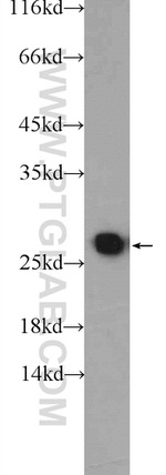 PSMA2 Antibody in Western Blot (WB)