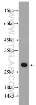 PSMA2 Antibody in Western Blot (WB)