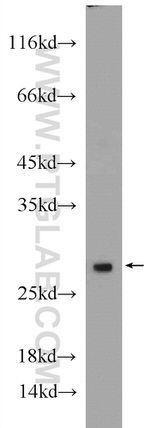 PSMA2 Antibody in Western Blot (WB)