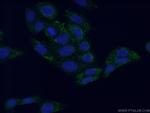 NIT1 Antibody in Immunocytochemistry (ICC/IF)