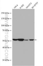 Fascin Antibody in Western Blot (WB)