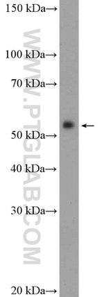 Fascin Antibody in Western Blot (WB)