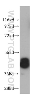 Casein Kinase 1 delta Antibody in Western Blot (WB)