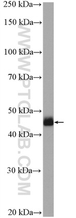 Casein Kinase 1 delta Antibody in Western Blot (WB)