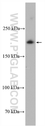 PASK Antibody in Western Blot (WB)