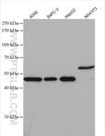 SCPx Antibody in Western Blot (WB)