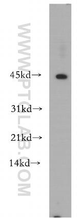 SCPx Antibody in Western Blot (WB)