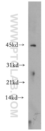 SCPx Antibody in Western Blot (WB)