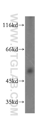 SCPx Antibody in Western Blot (WB)