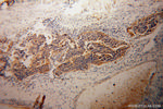 LDHD Antibody in Immunohistochemistry (Paraffin) (IHC (P))