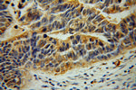 LDHD Antibody in Immunohistochemistry (Paraffin) (IHC (P))