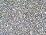 LDHD Antibody in Immunohistochemistry (Paraffin) (IHC (P))