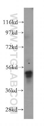 LDHD Antibody in Western Blot (WB)