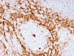 Granulocyte-Colony Stimulating Factor (G-CSF) Recombinant Rabbit Monoclonal Antibody (CSF3, 3166R)